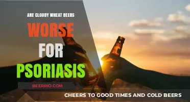 Exploring the Impact of Cloudy Wheat Beers on Psoriasis Symptoms