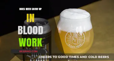 Exploring the Effects: Does Beer Consumption Appear in Blood Work?
