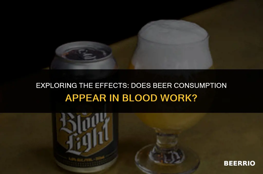does beer show up in blood work
