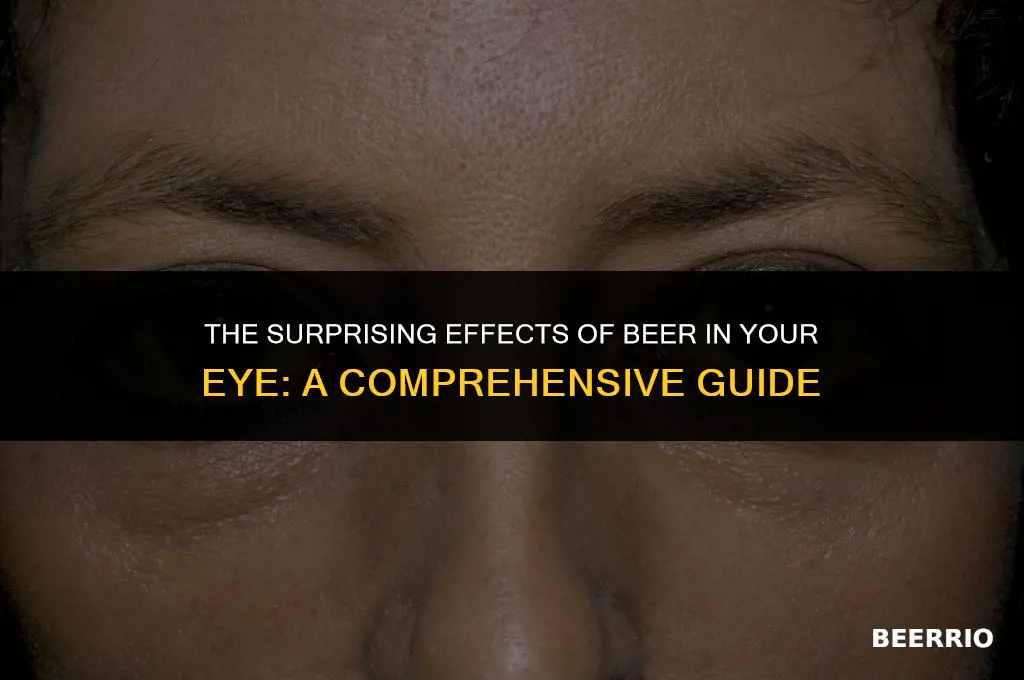 what happens if beer gets in your eye